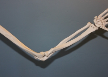 Wenn die Knochen dünn und brüchig werden