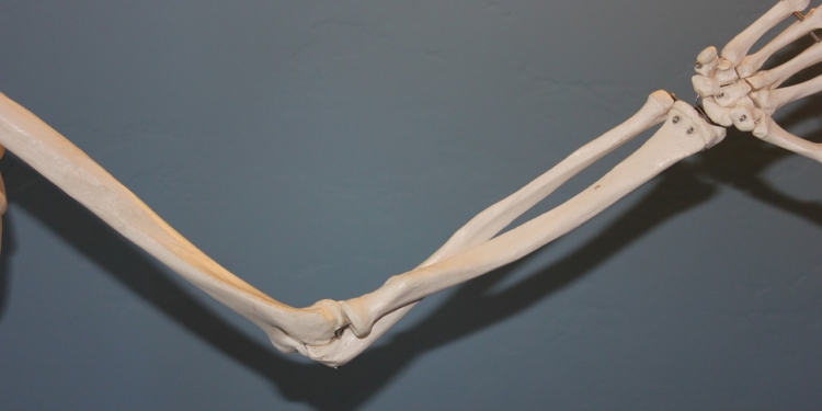 Wenn die Knochen dünn und brüchig werden