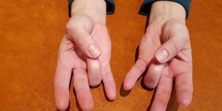 Jin Shin Jyutsu ab März bei der MSV