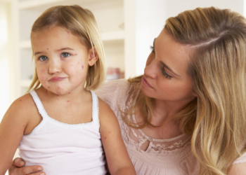 Mehr Windpocken-Fälle im Kreis Herzogtum Lauenburg