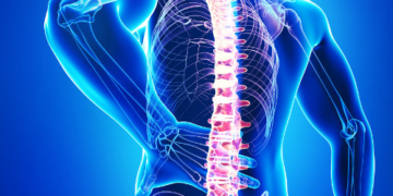 Rückenschmerzen verursachen im Kreis Herzogtum Lauenburg fast 22.700 Ausfalltage