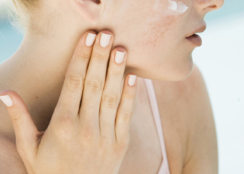 Sommer, Sonne, Juckreiz