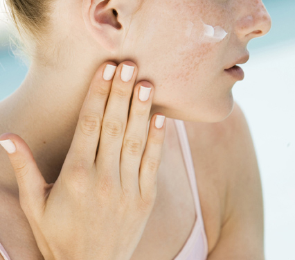 Sommer, Sonne, Juckreiz