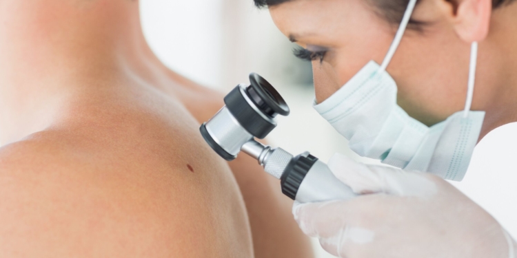 Hautkrebs-Screening im Kreis Herzogtum Lauenburg wird immer weniger genutzt