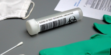 Corona-Test – gewusst wo und wie