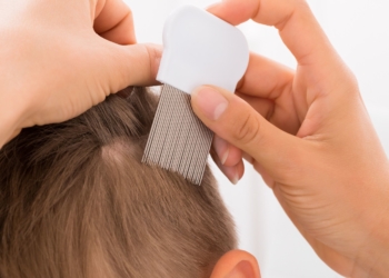 Weniger Kopfläuse im Kreis Herzogtum Lauenburg