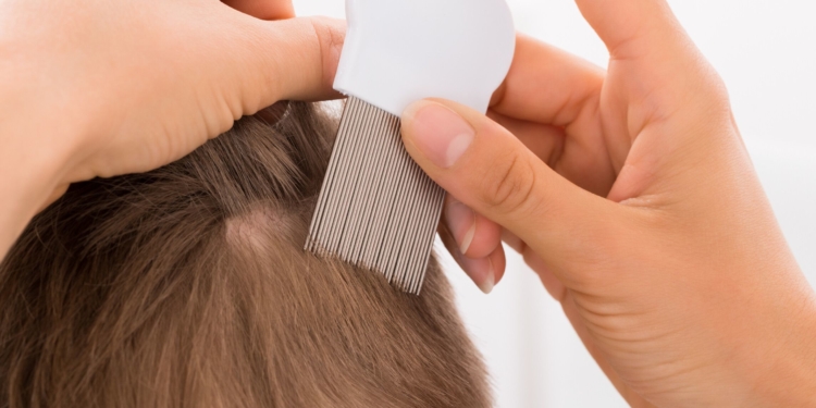 Weniger Kopfläuse im Kreis Herzogtum Lauenburg