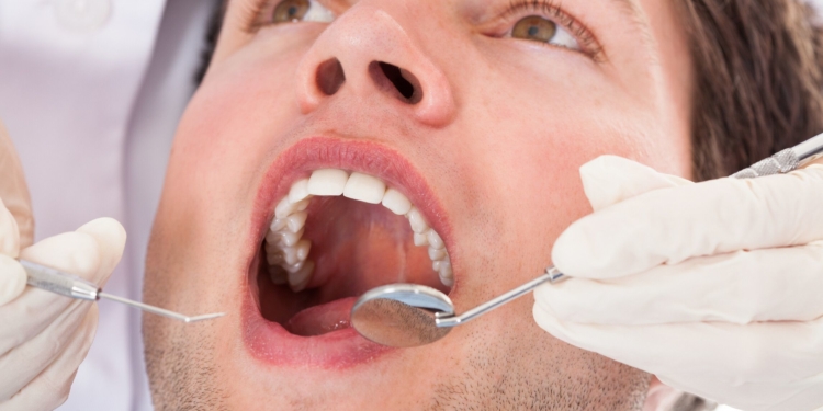 Im Kreis Herzogtum Lauenburg erhalten Frauen häufiger Zahnersatz als Männer