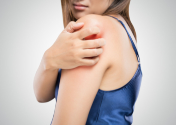 Krätze-Fälle im Kreis Herzogtum Lauenburg gesunken