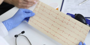 Herz-Kreislauferkrankungen weiterhin häufigste Ursache bei Krankenhauseinweisungen im Kreis Herzogtum Lauenburg