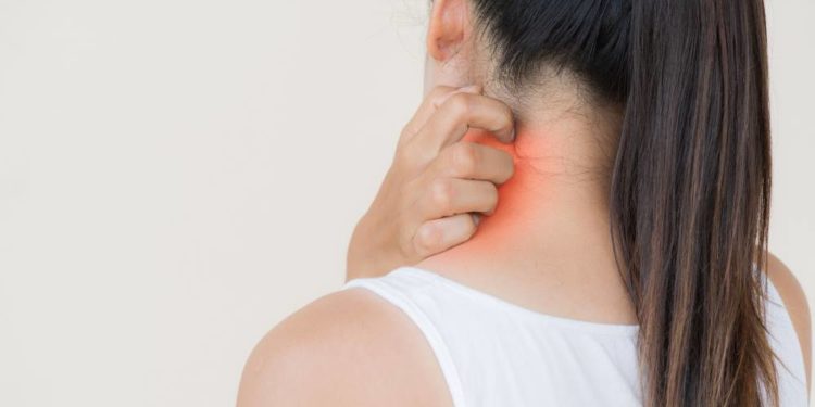 Mehr Krätze-Fälle im Kreis Herzogtum Lauenburg