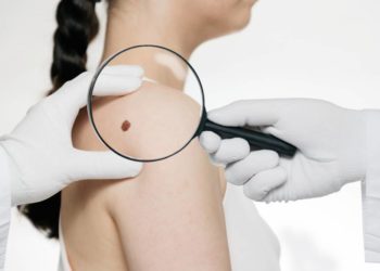 Hautkrebs-Screening wieder mehr genutzt