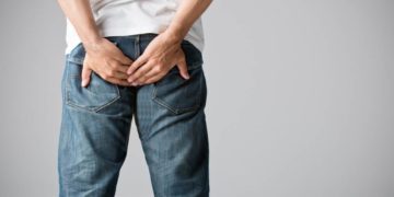 Tabuthema Hämorrhoiden – gar nichts so Ungewöhnliches