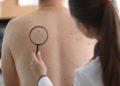 Hautkrebs-Screening im Herzogtum Lauenburg immer weniger genutzt