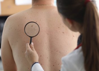 Hautkrebs-Screening im Herzogtum Lauenburg immer weniger genutzt