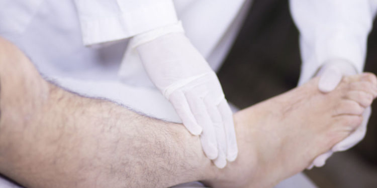 610 Menschen leiden im Kreis Herzogtum Lauenburg an Gicht