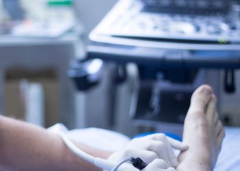 Krampfadern und Besenreißer nicht unterschätzen