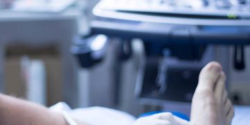 Krampfadern und Besenreißer nicht unterschätzen