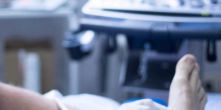 Krampfadern und Besenreißer nicht unterschätzen