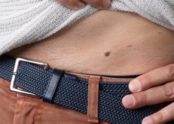 Hautkrebs-Screening bleibt auf niedrigem Niveau 