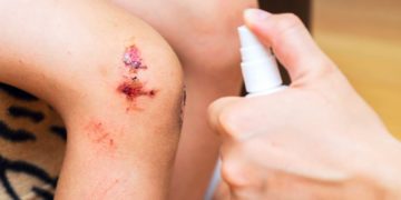 Sepsis ist eine oft unterschätzte Gefahr