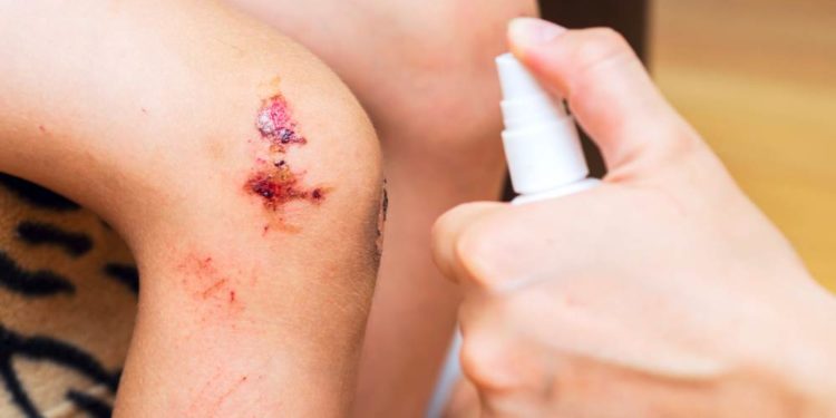 Sepsis ist eine oft unterschätzte Gefahr