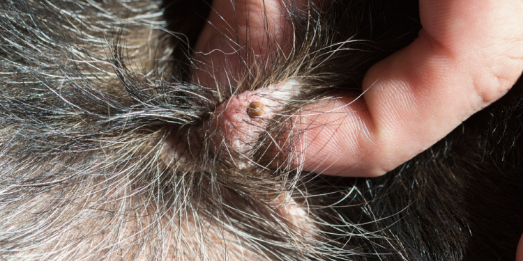 Kleine Plagegeister längst unterwegs