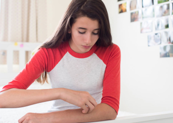 Rückgang der Krätze-Fälle im Kreis Herzogtum Lauenburg