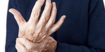 Gelenkschmerzen für 2.500 an rheumatoider Arthritis Erkrankte im Kreis